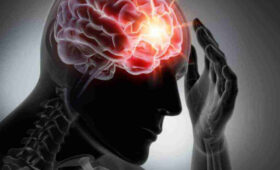 Струс мозку: як допомогти?