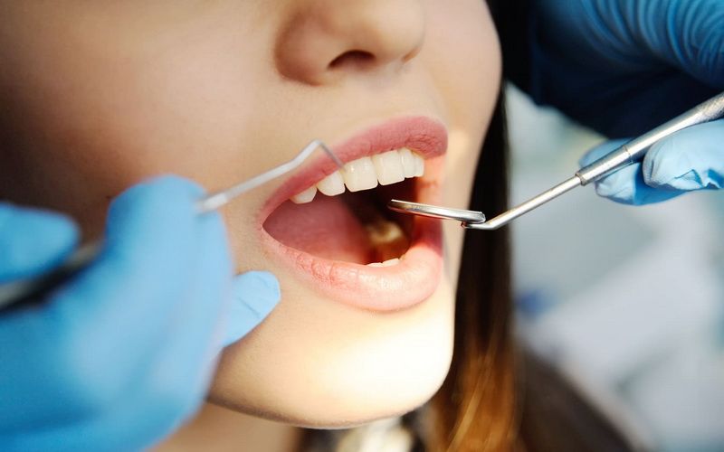 П'ять порад для здоров’я зубів та красивої усмішки